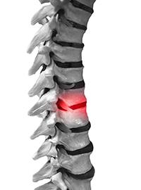 troubles musculo-squelettiques troubles musculo-squelettiques